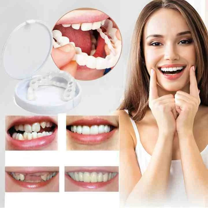 Reusable Temporary Tooth Cover with Heat-Moldable Fitting Beads