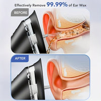 Electric Ear Cleaner with Three Speed Water Pressure and Rechargeable Battery
