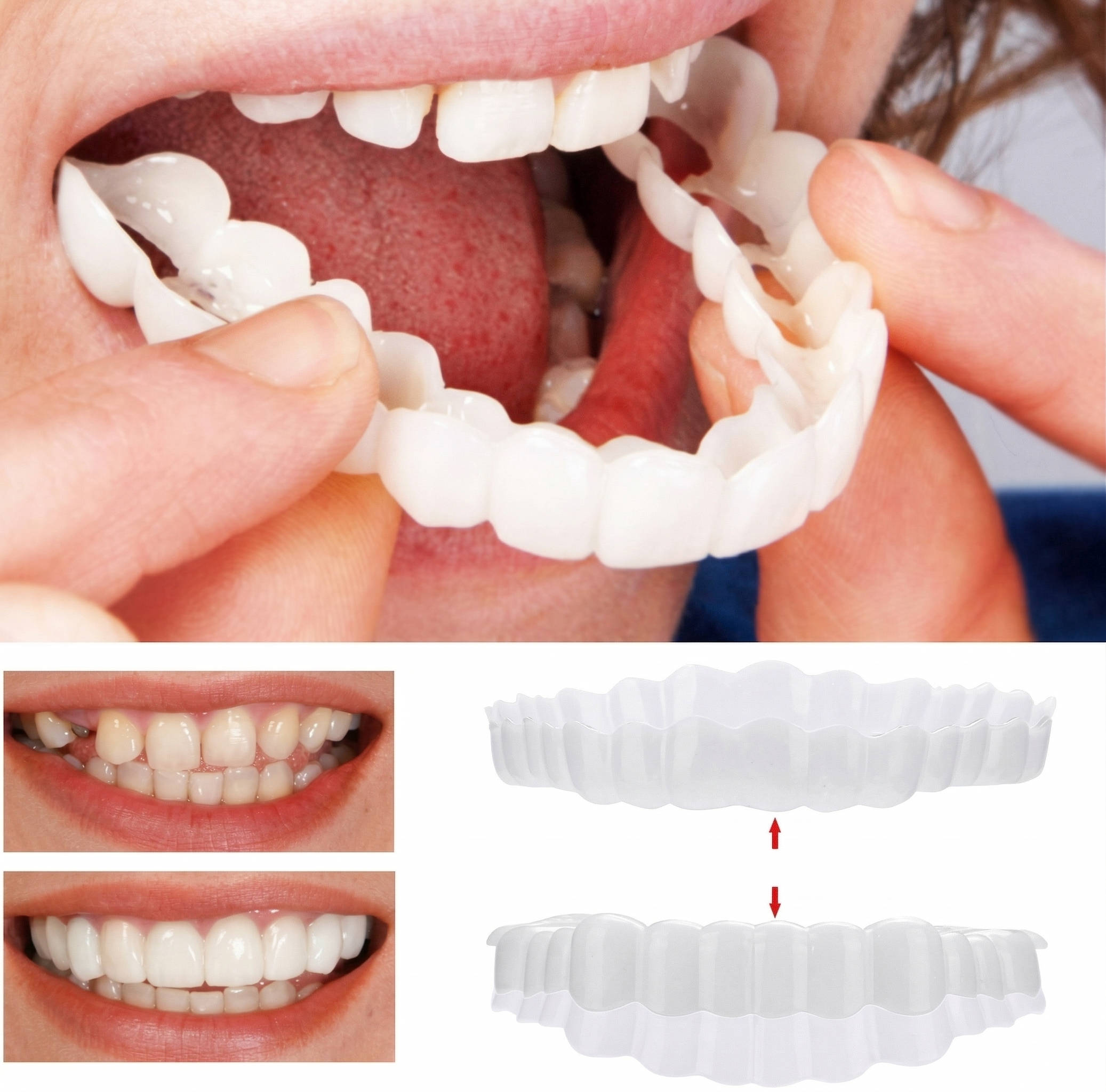 Reusable Temporary Smile Veneer Top and Bottom Set