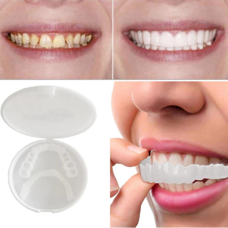 Reusable Temporary Tooth Cover with Heat-Moldable Fitting Beads