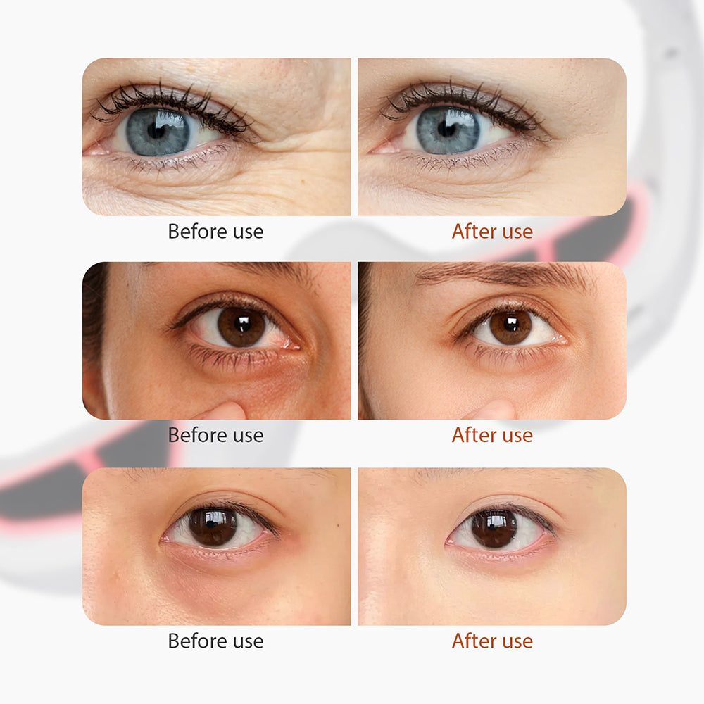 Wearable Eye Massager with Red Light and Four Massage Modes