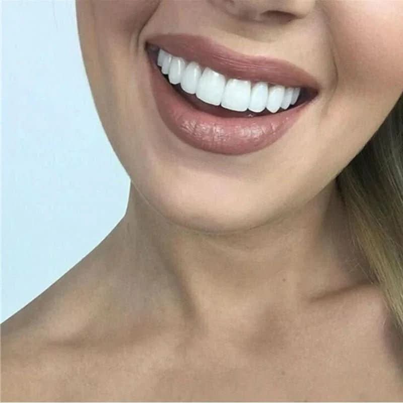 Reusable Dental Veneers with Heat Moldable Fit and Stain Coverage