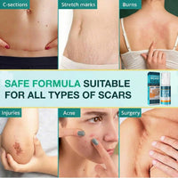 Silicone Scar Gel Moisturizing Cream for Skin Marks and Stretch Marks