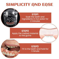 Snap-On Silicone Denture Set with Adjustable Fit and Realistic Tooth Design
