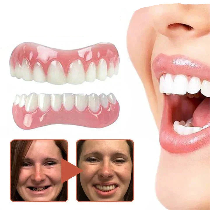 Snap-On Silicone Denture Set with Adjustable Fit and Realistic Tooth Design