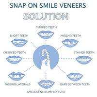 Clip On Teeth Veneer Set for Upper and Lower Coverage
