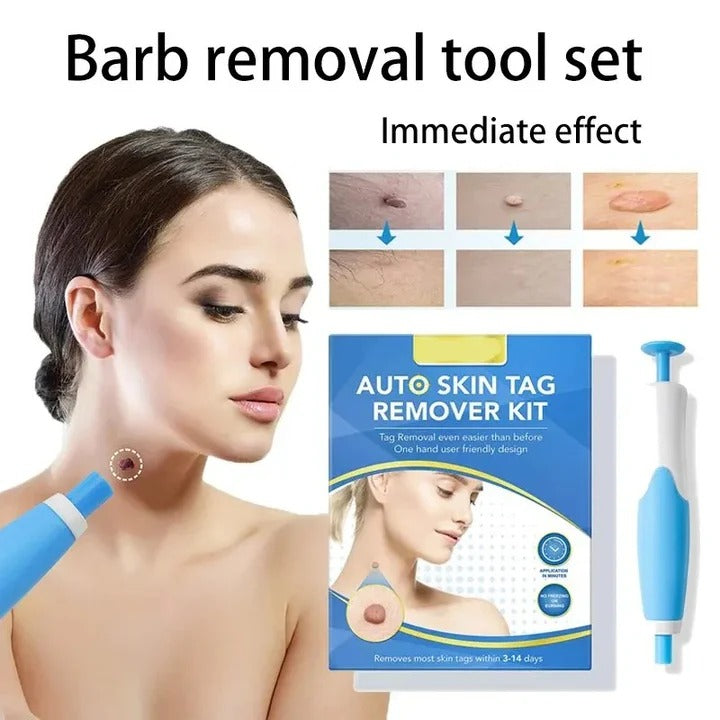 Skin Tag Banding Tool Kit with Applicator and Bands