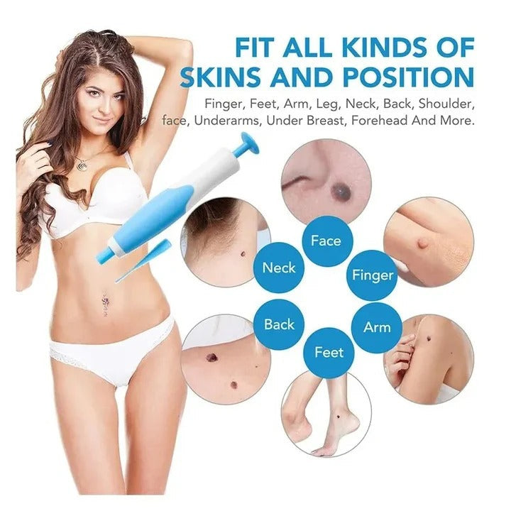 Skin Tag Banding Tool Kit with Applicator and Bands