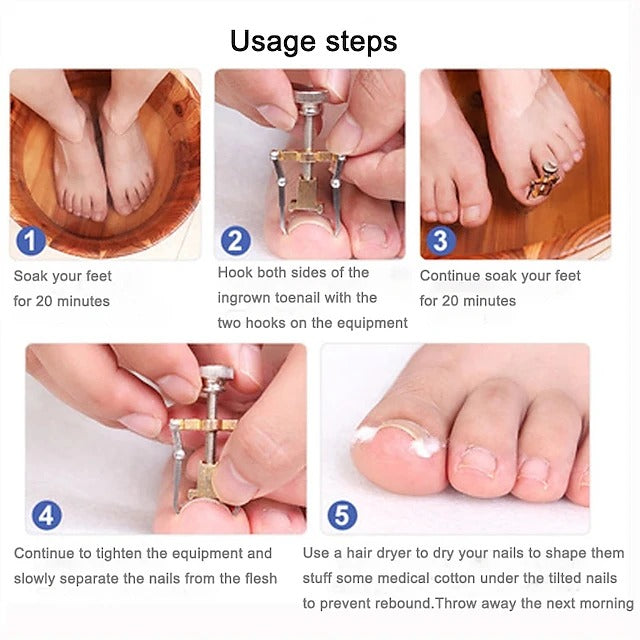 2 Piece Toenail Correction Clip Set with Stainless Steel Straightening Tool for Nail Care