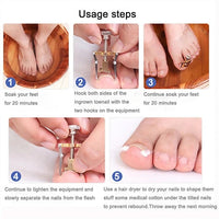 2 Piece Toenail Correction Clip Set with Stainless Steel Straightening Tool for Nail Care