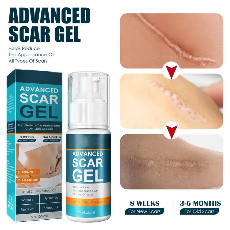 Silicone Scar Gel Moisturizing Cream for Skin Marks and Stretch Marks