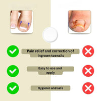 Instant Nail Repair Corrector for Ingrown and Damaged Nails