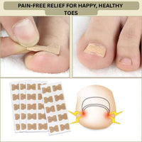 Instant Nail Repair Corrector for Ingrown and Damaged Nails
