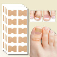 Instant Nail Repair Corrector for Ingrown and Damaged Nails